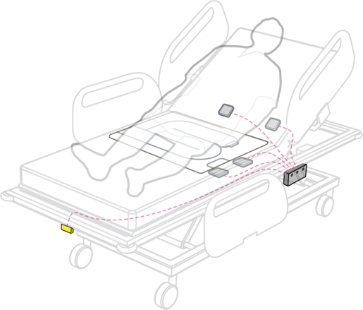 WatchCare™ Incontinence Management System WatchCare™ Incontinence Management System